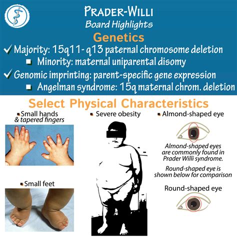 prada wille|prader willi syndrome in adults.